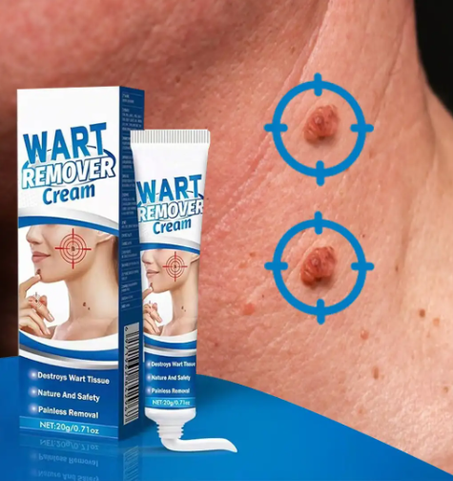 كريم لإزالة الثآليل