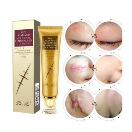 كريم إزالة الندبات والحروق وآثار حب الشباب