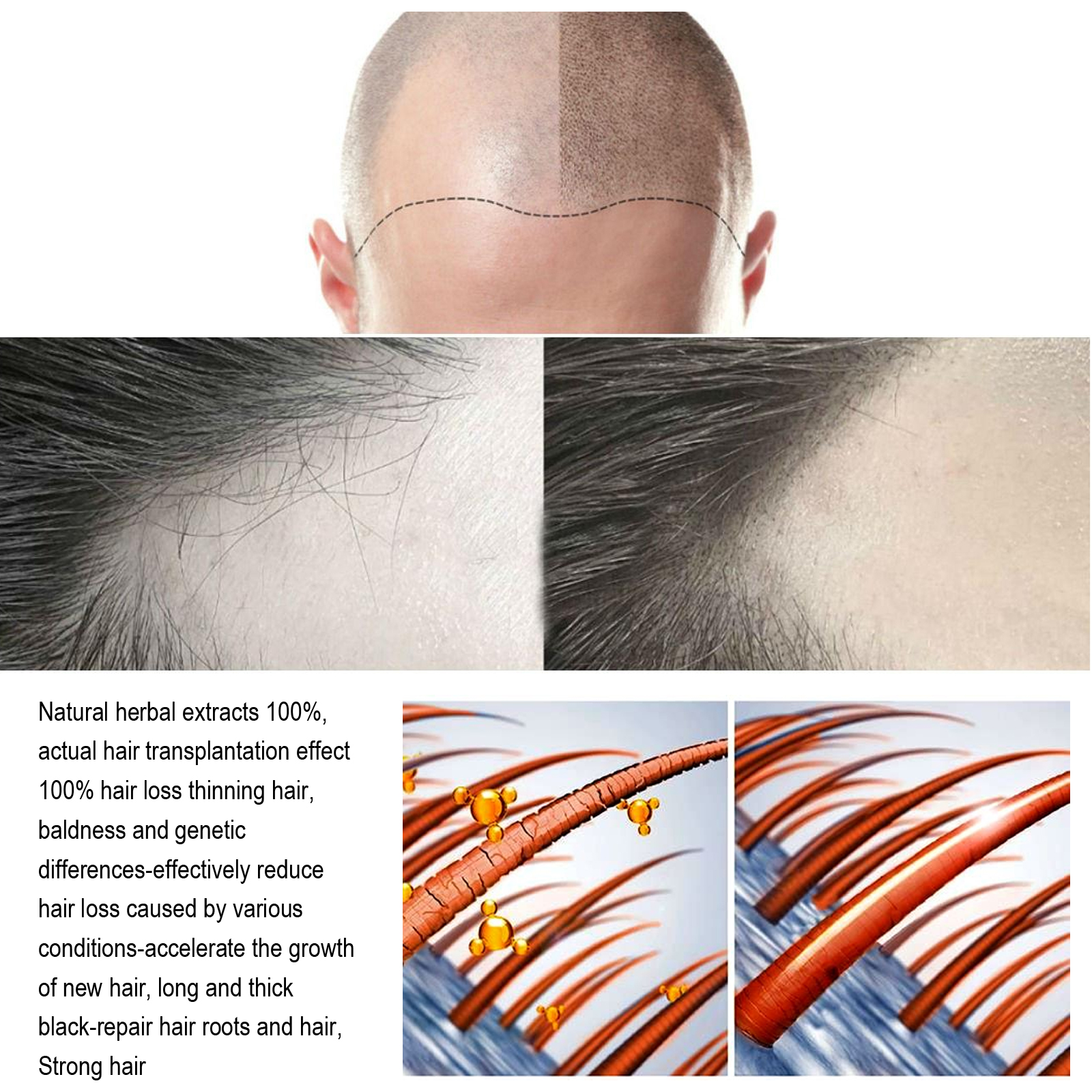 Jaysuing HAIR TREATMENT - QAT