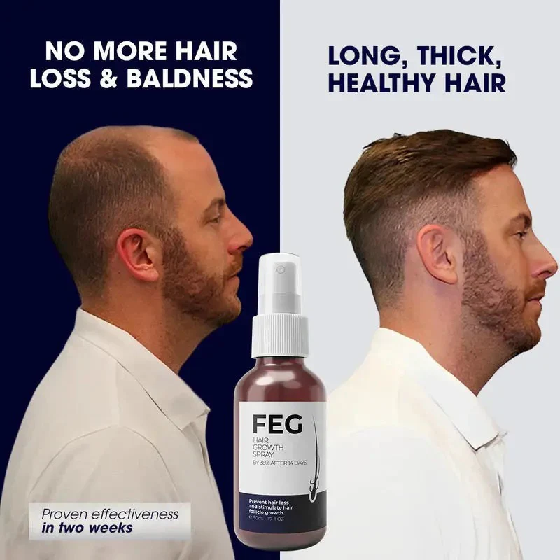 بخاخ FEG Plus لتكثيف ونمو الشعر