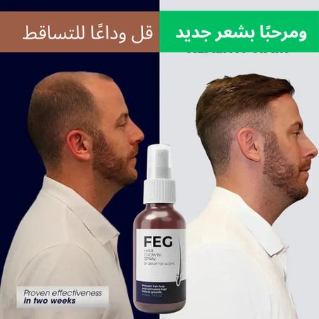 بخاخ FEG Plus لتكثيف ونمو الشعر