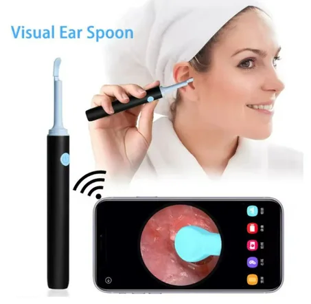 تلسكوب تنظيف الأذن