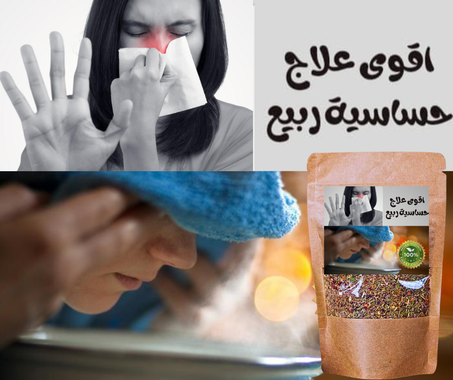 اقوى علاج للحساسية طبيعي %100