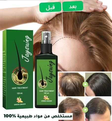 بخاخ الزنجبيل لتحفيز نمو الشعر