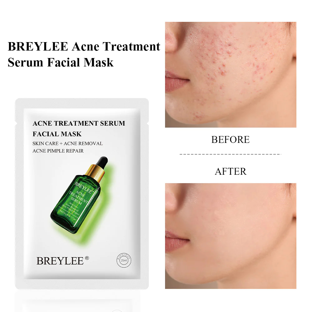 ماسك بريلي الورقي لعلاج حب الشباب – BREYLEE Acne Facial Mask بخلاصة شجرة الشاي | تهدئة البثور وتنقية البشرة | قطعة واحدة 25مل