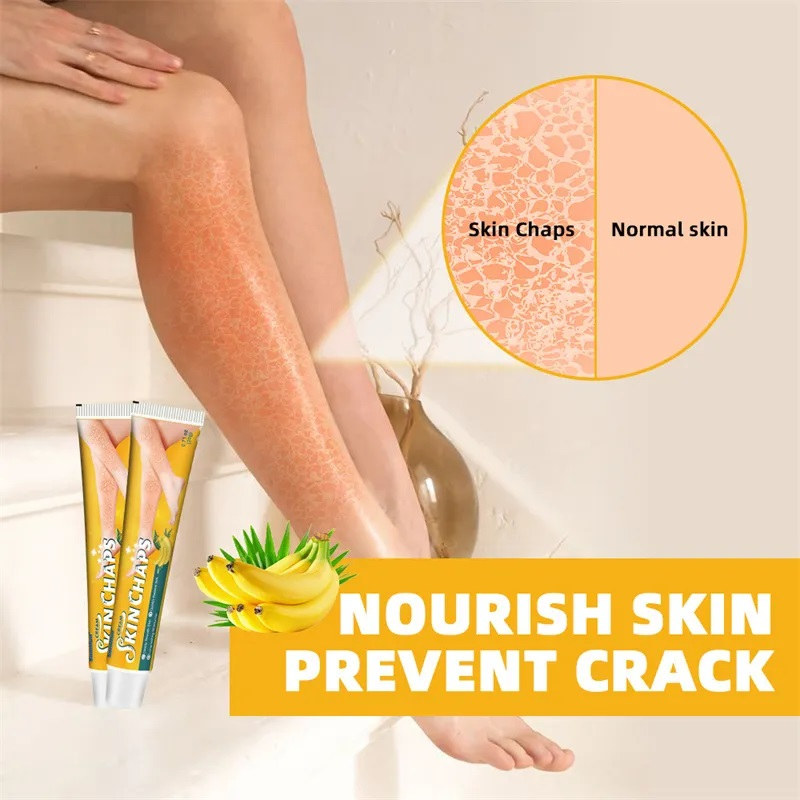 كريم Skin Chaps لعلاج جفاف الجلد وتشققاته – كريم موز طبيعي بتركيبة عشبية لتنعيم وتفتيح البشرة 20غ