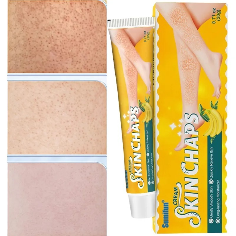 كريم Skin Chaps لعلاج جفاف الجلد وتشققاته – كريم موز طبيعي بتركيبة عشبية لتنعيم وتفتيح البشرة 20غ
