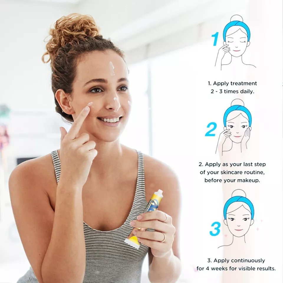 كريم إزالة حب الشباب من Sumifun - علاج فعّال وآمن للبشرة المعرضة لحب الشباب - يرطب، يفتح، ويزيل البقع خلال 4 أسابيع