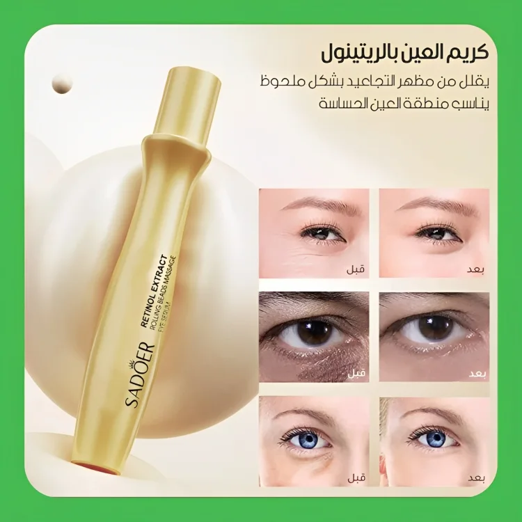 كريم الهالات السوداء المحيطة بالعين