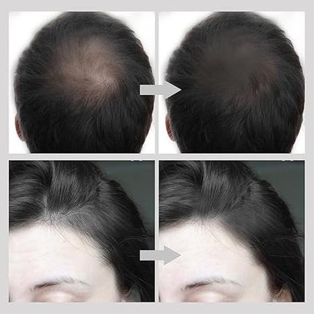 بودرة ملء فراغات الشعر - Hairline Shadow Powder