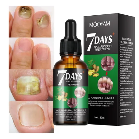 Serum ya Mafuta ya Kuchangamsha & Kuimarisha Kucha