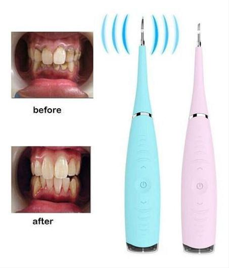 أداة لإزالة الكاركير من الأسنان فعالة 100%