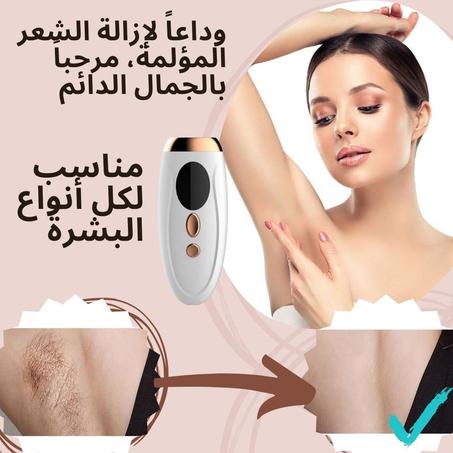 جهاز ازالة الشعر بالليزر