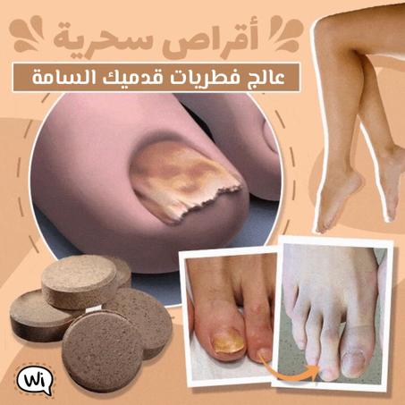 Pied Soins - أقراص القدم المضادة للفطريات
