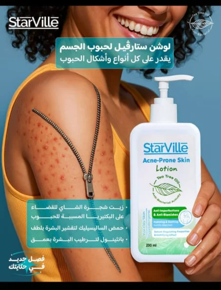 لوشن ستارفيل لحبوب الجسم