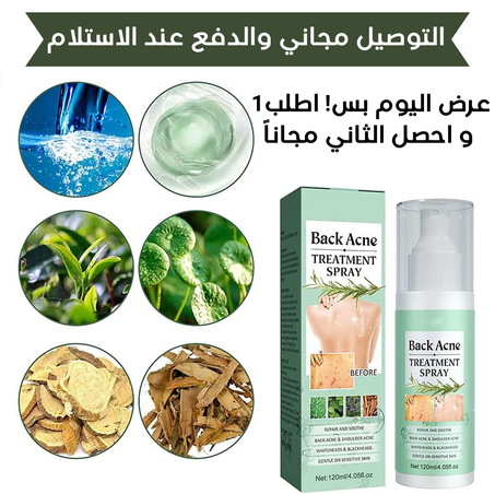 🖤✨ بخاخ علاج حب الشباب للظهر والكتف – JAYSUING ✨🖤