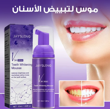 مبيض الأسنان