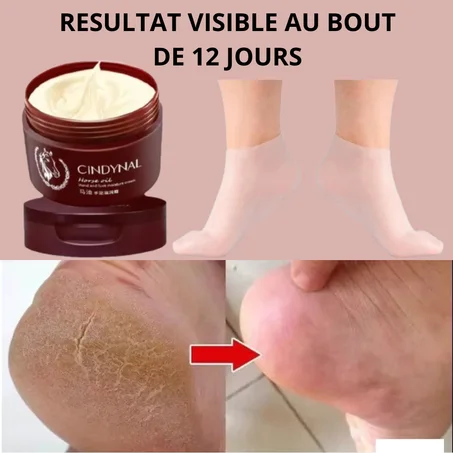Crème + Chaussettes Hydratantes en Silicone