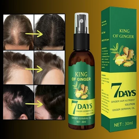 زيت الزنجبيل للشعر