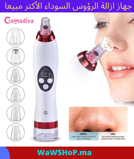 جهاز ازالة الرؤوس السوداء