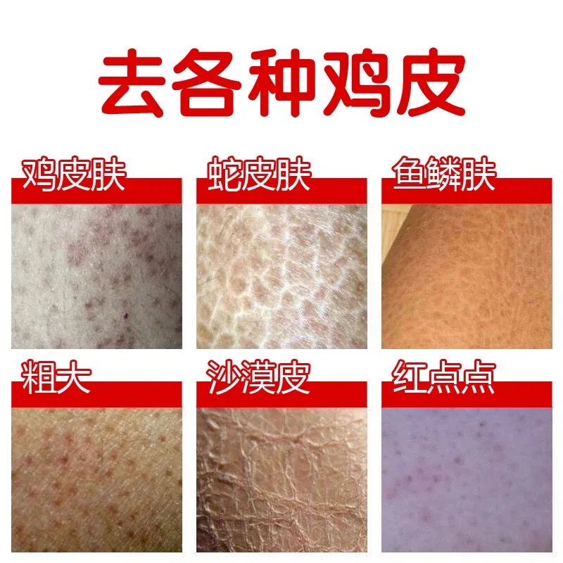 Cuticle Repair Cream