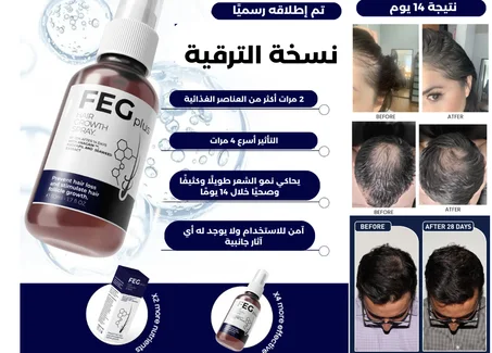 زيت FEG سر الشعر الصحي والقوي لكل من يعاني من تساقط الشعر