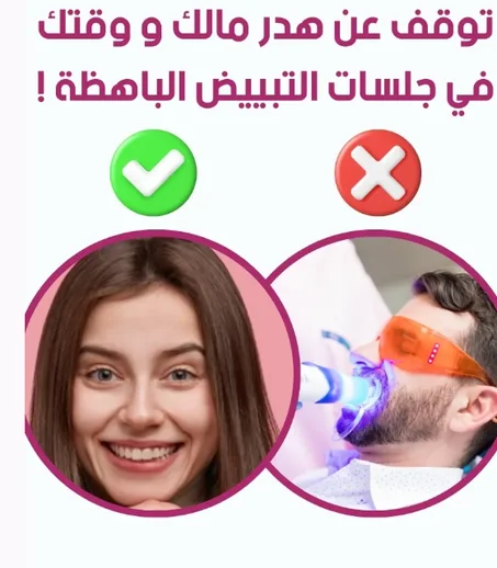 قلم تبييض الأسنان