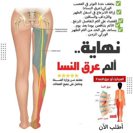 مرهم Joint FleX لعلاج عرق النسا