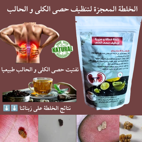 الخلطة المعجزة لتنظيف حصى الكلى و الحالب