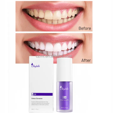 مبيض الأسنان