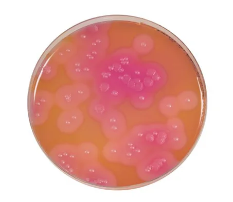 Bacillus cereus selon Mossel – Gélose sélective pour Mossel
