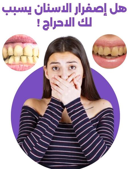 HiSmile... بياض يبهرك !