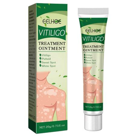 Pommade De Traitement Du Vitiligo