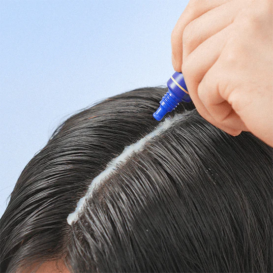 [FORBEAUT] مقشر فروة الرأس المنظف العميق (1 علبة = 15غ × 4 قطع