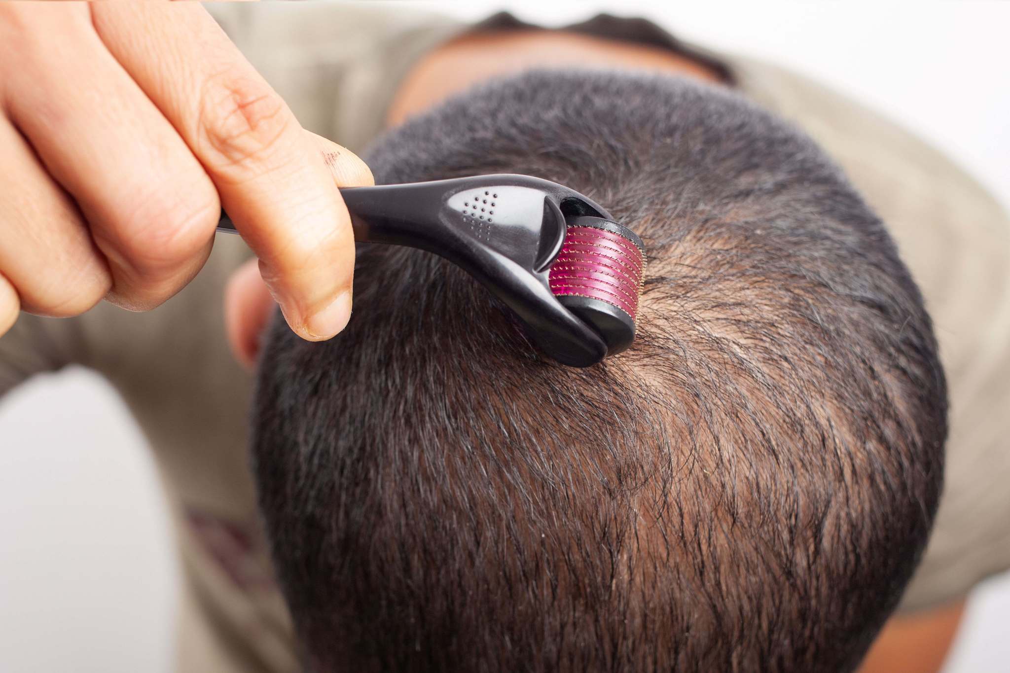Derma roller