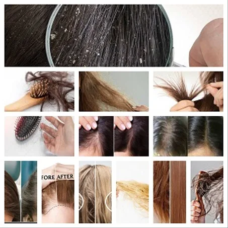 مجموعة العناية بالشعر