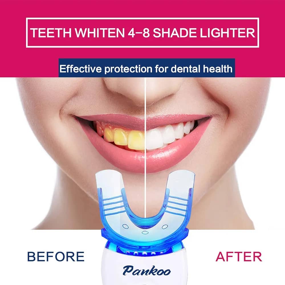 جهاز تبييض الأسنان بالأشعة فوق البنفسجية يغنيك عن جلسات التنظيف في عيادة الاسنان
