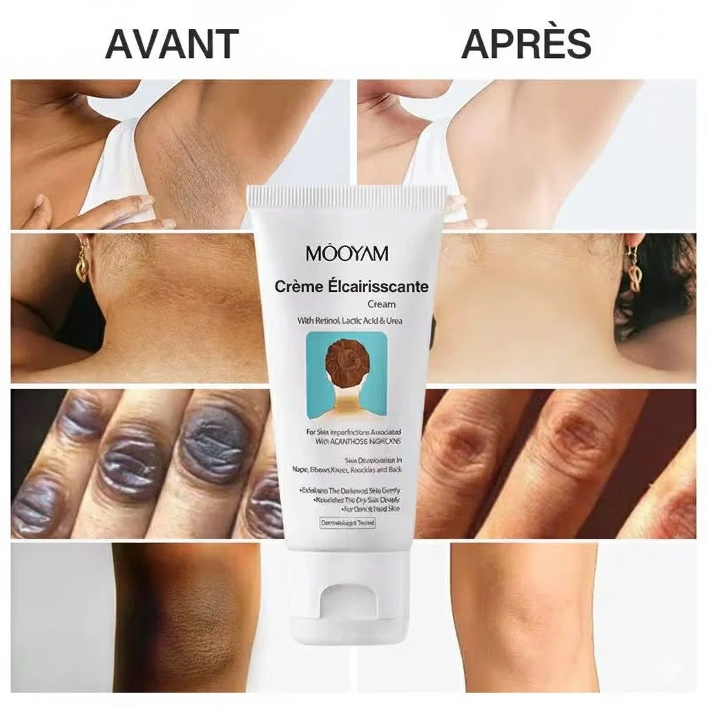Crème Éclaircissante & Unifiante MOOYAM