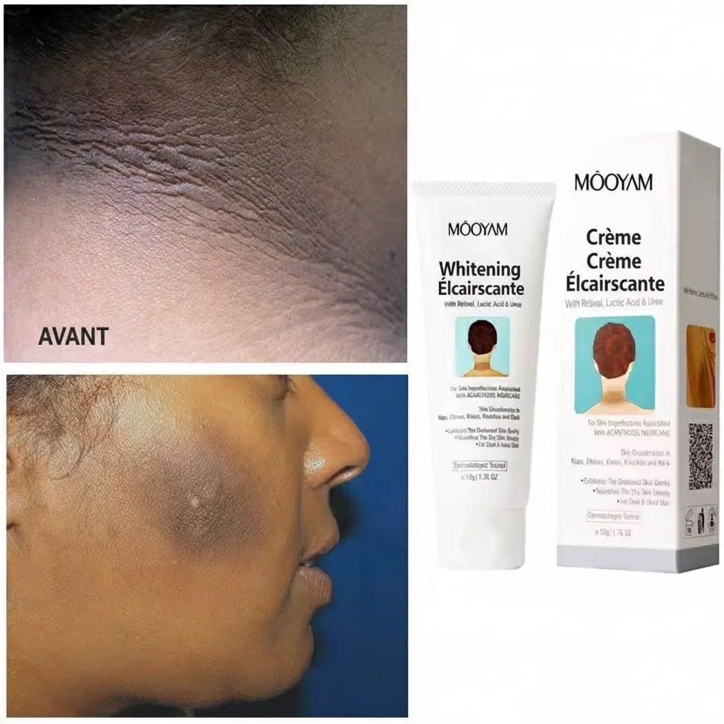 Crème Éclaircissante & Unifiante MOOYAM