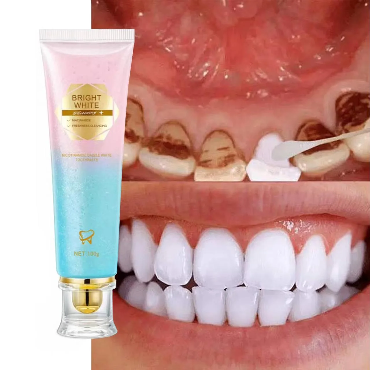 Dentifrice Blanchissant YECUOCE® au Niacinamide