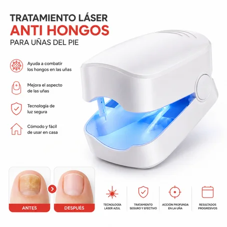 Láser para Uñas Antihongos – Tratamiento Cómodo desde Casa