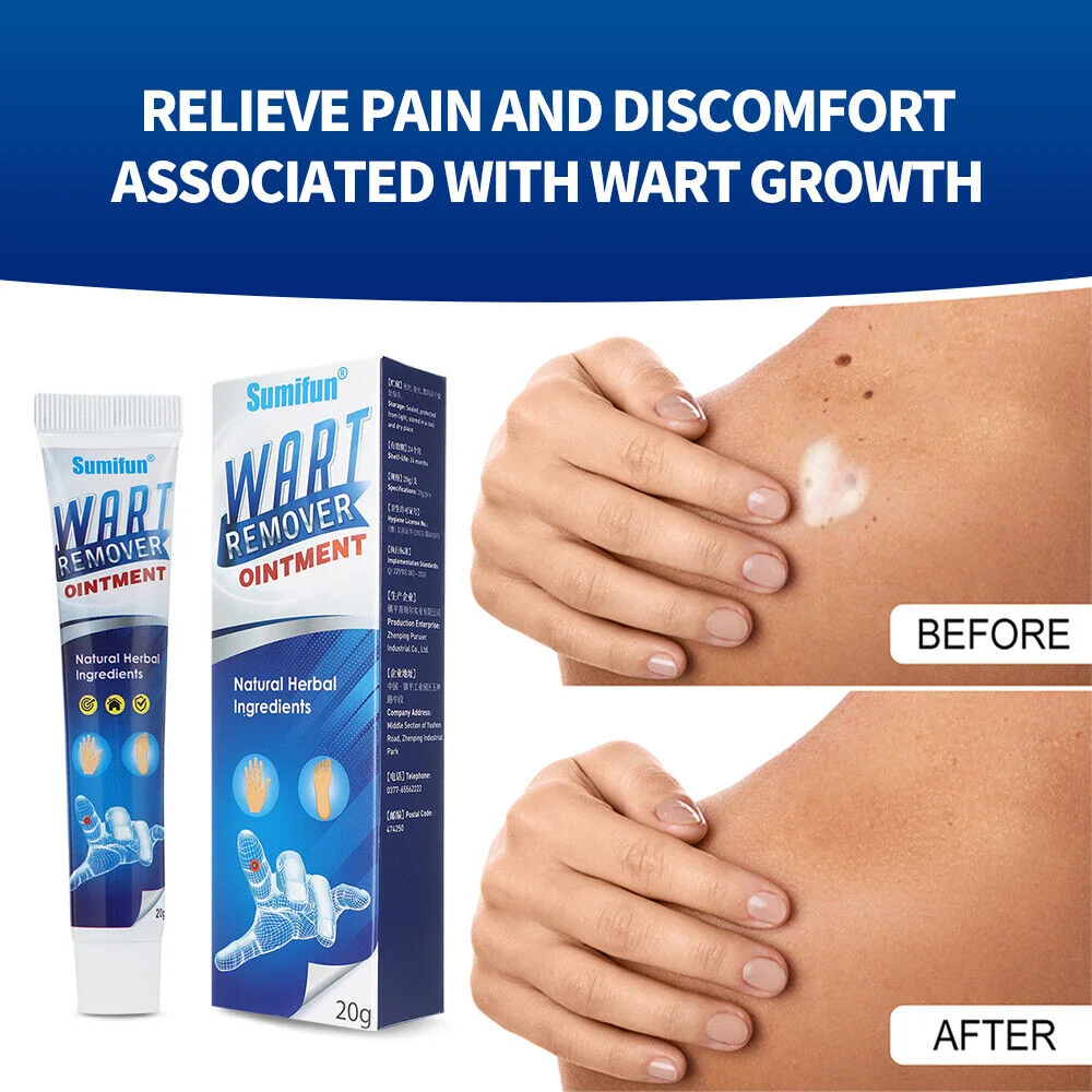 كريم إزالة الثأليل والعناية بالبشرة