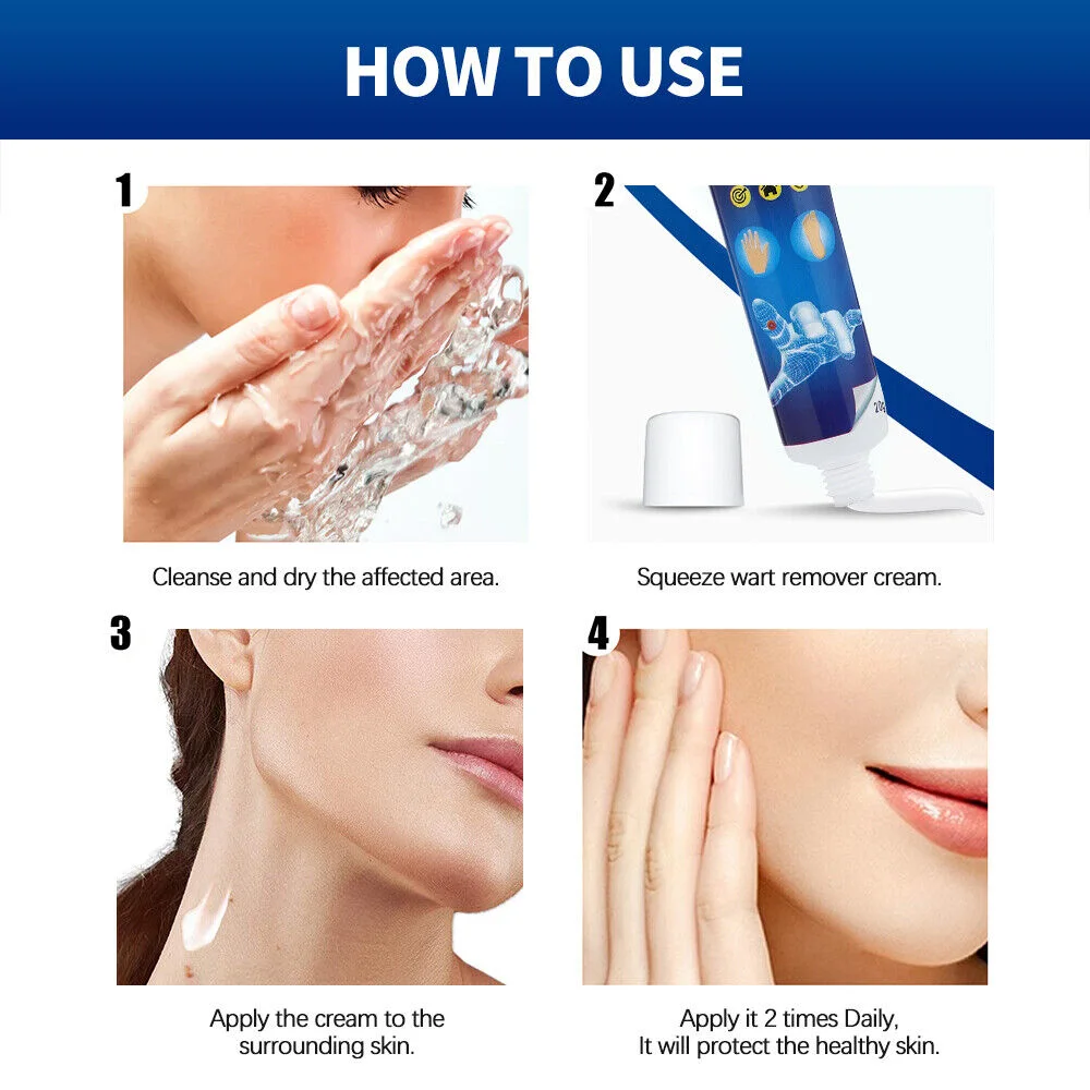 كريم إزالة الثأليل والعناية بالبشرة