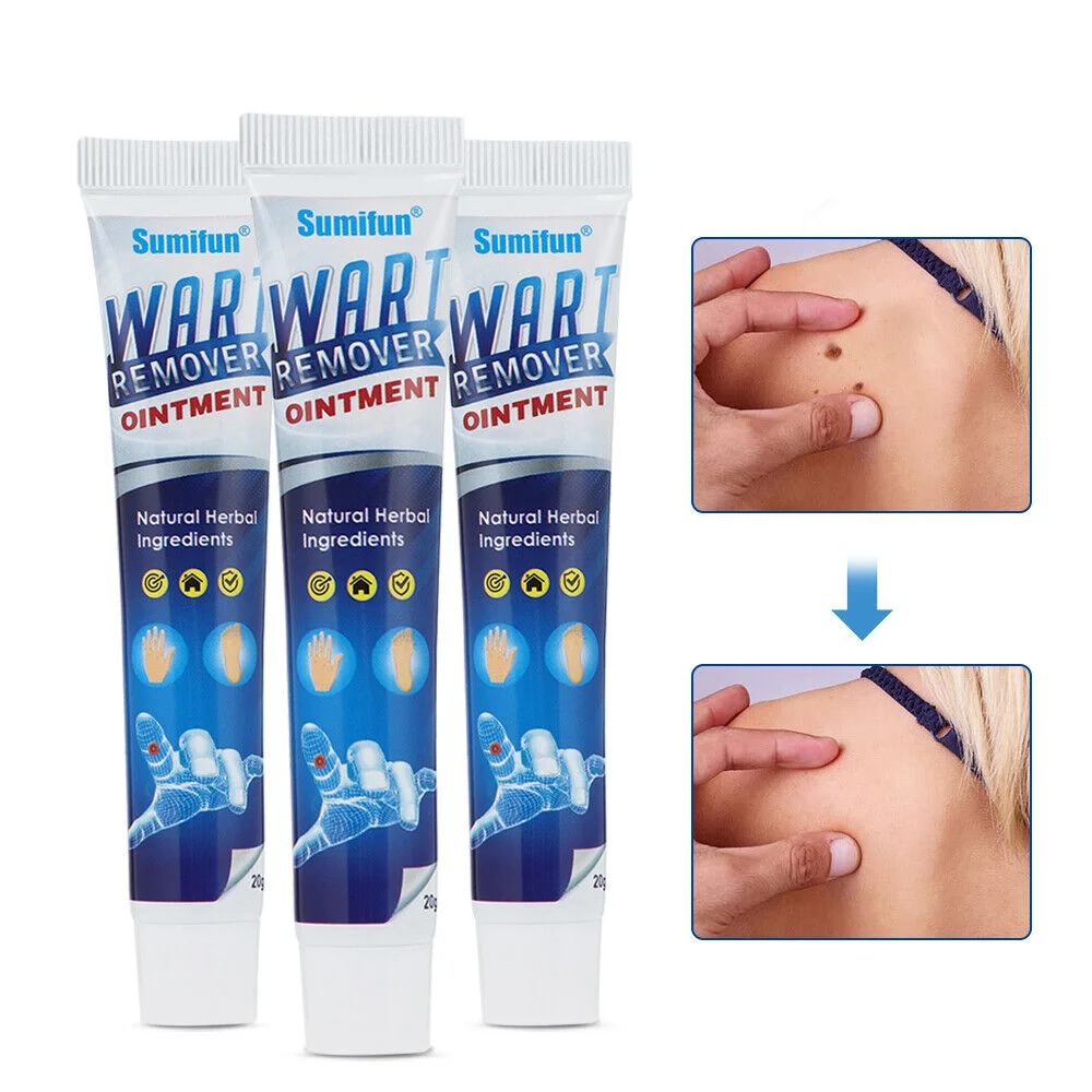 كريم إزالة الثأليل والعناية بالبشرة