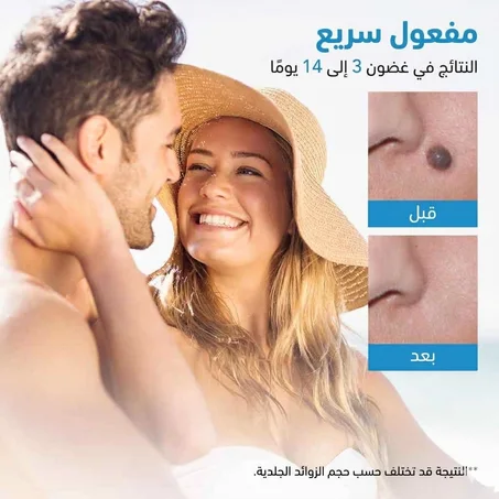 قلم إزالة الثآليل ذو الرأسين