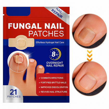 الملصق السحري لعلاج الفطريات و تصحيح اظافر القدم