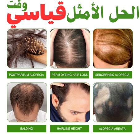 زيت الزنجبيل الطبيعي افضل زيت للشعر في السعودية حاليا