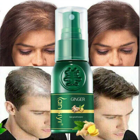 Spray capilar para crecer