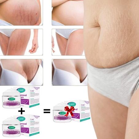 كريم ازلة الخطوط من الجسم scar removal cream
