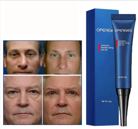 كريم العين الانتفاخ  Openeyes